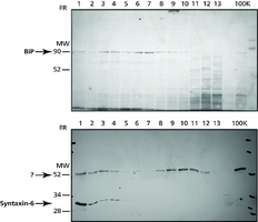 Endoplasmic Reticulum Isolation Kit isolation of intact ER from mammalian soft tissues and cultured